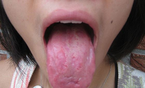piercing i tungen