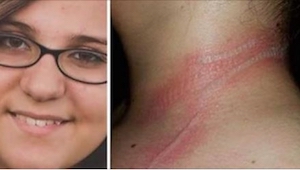 Třináctiletá holka utrpěla popáleniny těla, protože ... nesprávně používala mobi