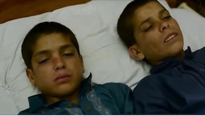 Případ 2 bratrů z Pákistánu je medicínskou záhadou! Jejich utrpení se začíná až 