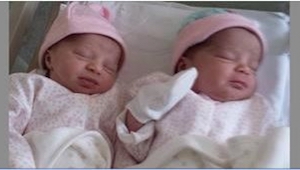 Narodila se jim jednovaječná dvojčata, alespoň si to mysleli, než je poprvé uvid