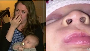 Chtěla své dítě kojit, když si všimla malých černých skvrnek v jeho nose… pak si