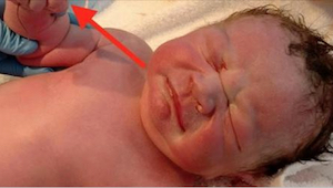Toto dítě se původně nemělo narodit… Když otevřeli jeho malinkou pěst, okamžitě 