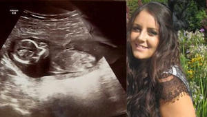 10 dnů po potratu nemohli uvěřit tomu, co spatřili na ultrazvuku! 
