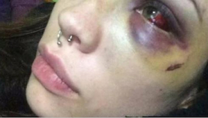 23letá žena na Facebooku sdílela děsivé fotografie. Nikdo nemohl uvěřit tomu, kd
